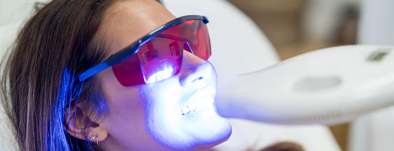 Unterschiedliche Bleaching-Verfahren der Zahnärzte im Schloss in Berlin Steglitz verhelfen vielen Patienten zu schönen, hellen Zähne.