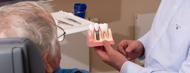 Jürgen Hellmer, Zahnarzt bei den Zahnärzten im Schloss Berlin Steglitz, erklärt einem Patienten anhand eines Modells die Funktionsweise von Implantaten.