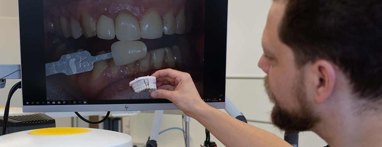 Zahntechnikermeister Chris Vörös vergleicht den fertigen Zahnersatz im Meisterlabor dent-a-pur Steglitz mit einer digitalen Aufnahme des Patienten.